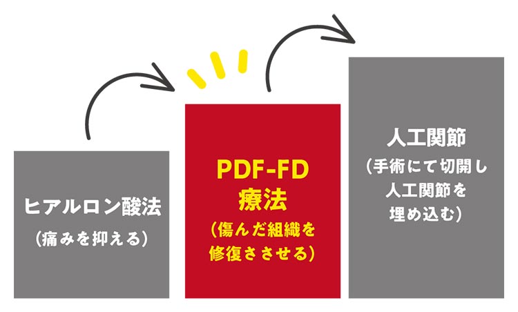 PDF-FD療法イメージ
